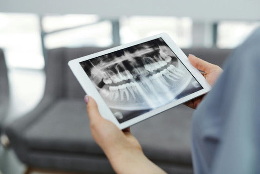 Say Goodbye to Gingivitis: Discover the Power of the Smarter Cleaner